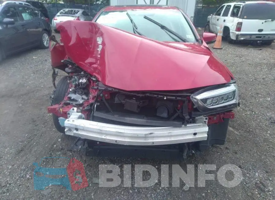 19UUB1F57JA004838 Photo# 6